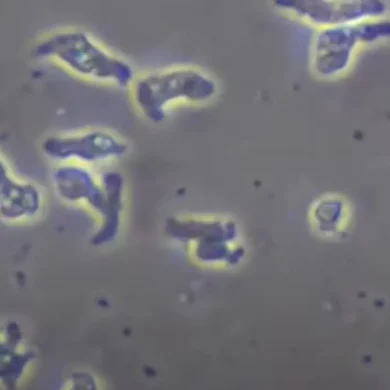 Jednobuněčný organismus, Prvok Naegleria fowleri, Mozkožravá améba, Měňavka